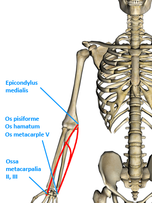 Epicondylopathia humeri ulnaris - der Werfer- oder Golferellenbogen